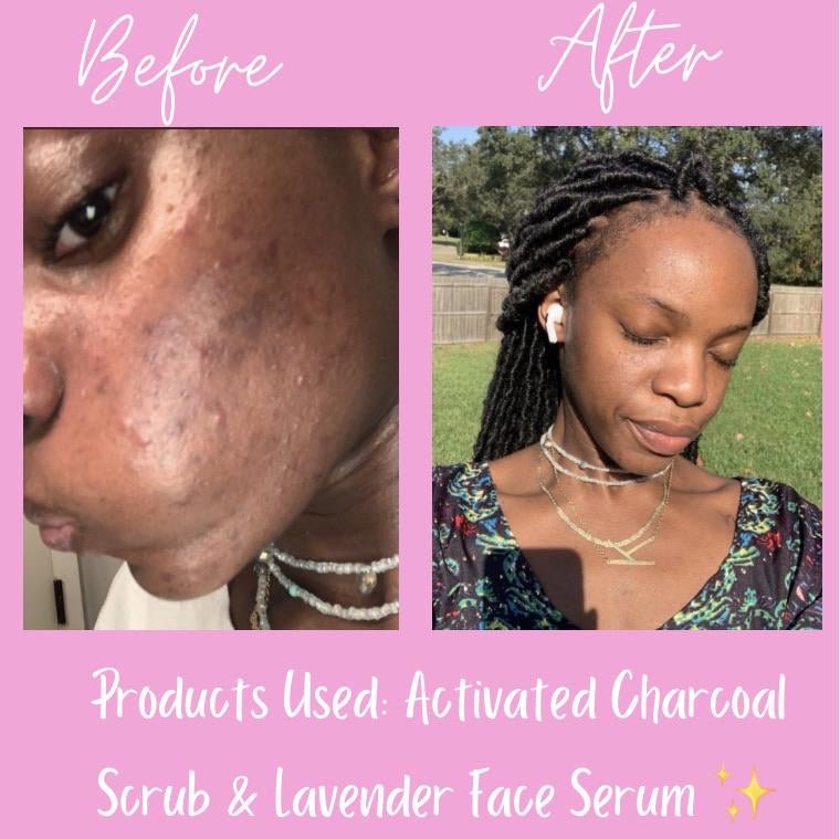 Fresh Face Serum